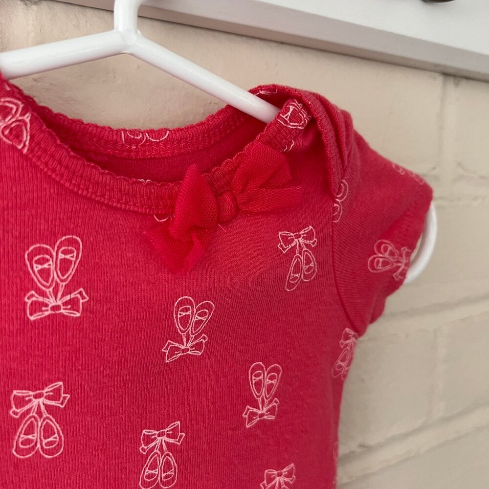 Baby Girl | Carter's | 3 PC Pink/White Bodysuits | 3M - Picture 7 of 9